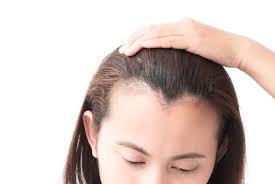 Hair loss Different type : संकेतों को कैसे पहचानें और इसका इलाज कैसे करें