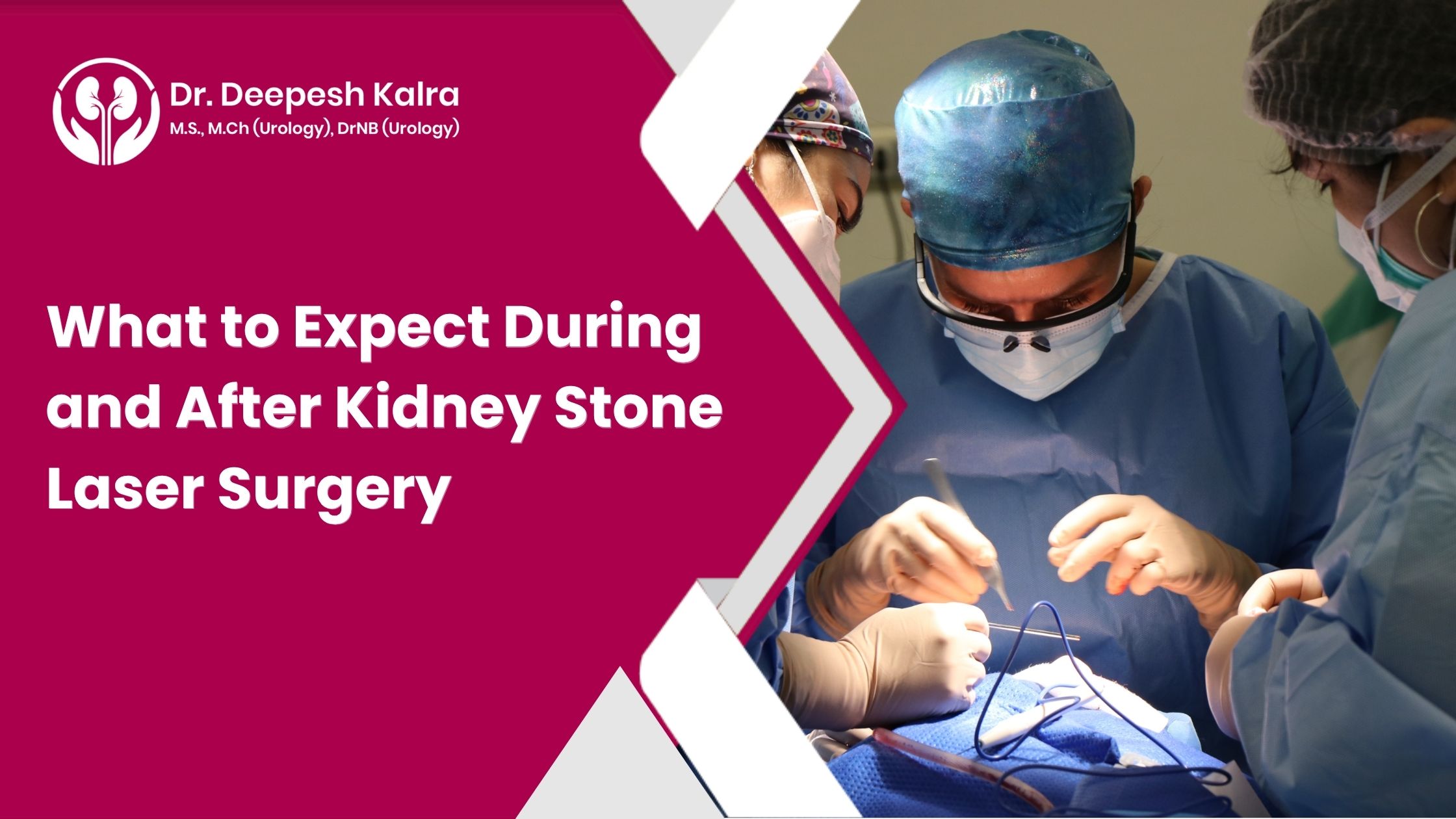 What to Expect During and After Kidney Stone Laser Surgery